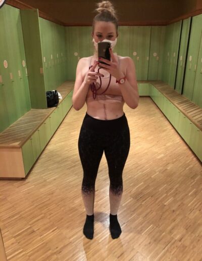 Aline im Fitnesstudio mit Darmverschluss-Narbe 2021